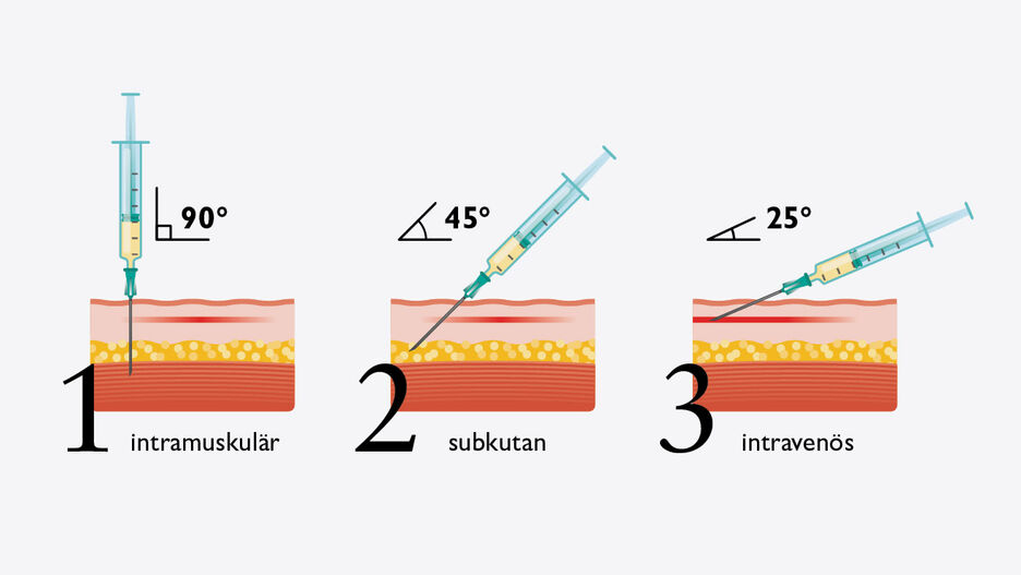 Darstellung der unterschiedlichen Verabreichungsformen von Injektionen und Infusionen.