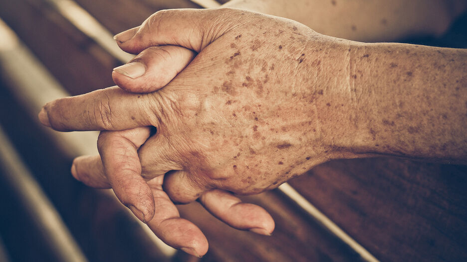 Nahaufnahme von gefalteten Händen eines Mannes. Seine Hände sind mit Altersflecken übersät.